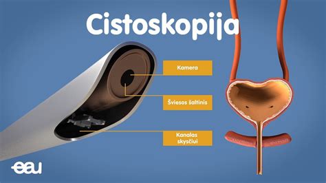 Symtom efter insättning av embryo